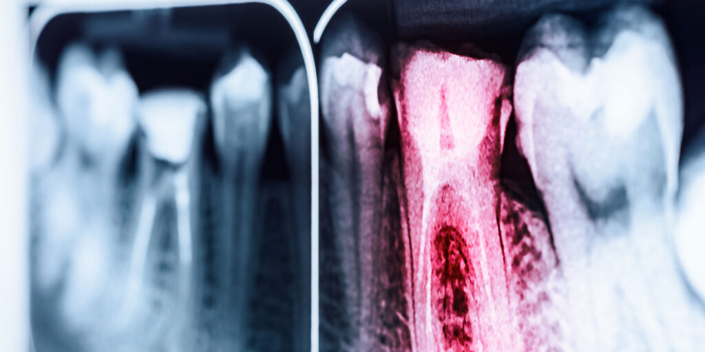 dental emergency fullwidth1