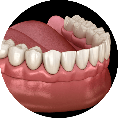 traditional dentures 3d graphic
