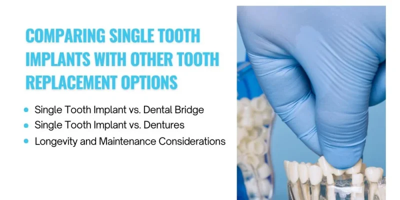 Comparing Single Tooth Implants With Other Tooth Replacement Options