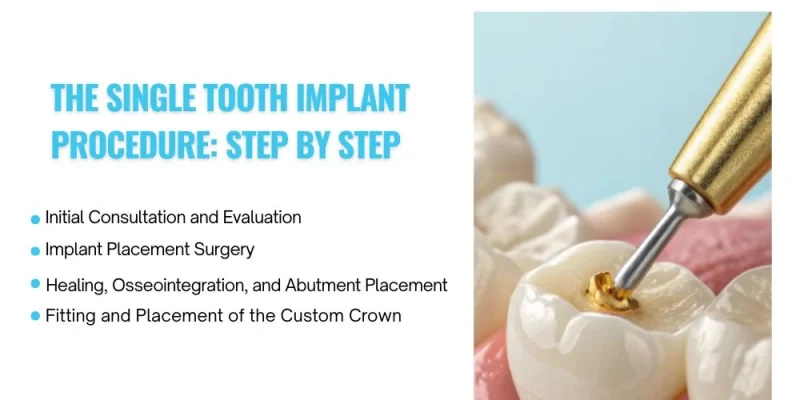 The Single Tooth Implant Procedure Step by Step