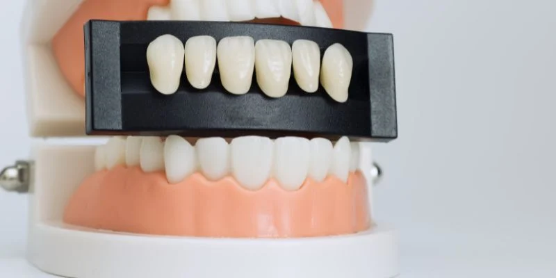 Porcelain Veneers vs. Teeth Whitening