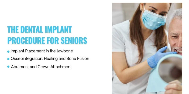 The Dental Implant Procedure for Seniors