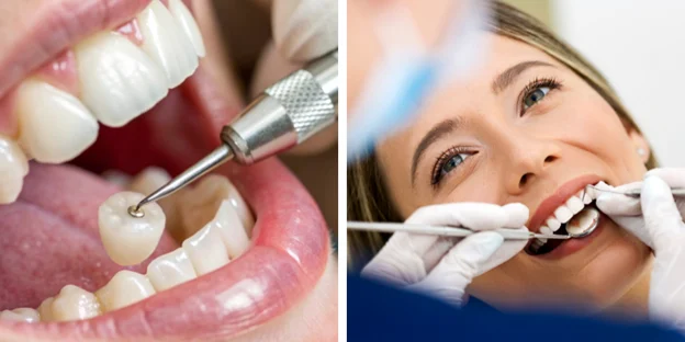 What Is a Dental Crown