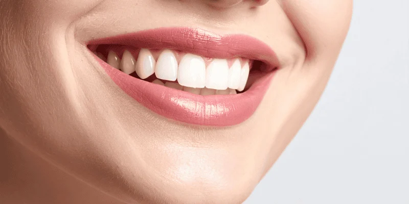 Full Mouth Dental Implants Post-Surgery Care