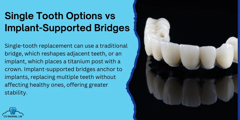 Single Tooth vs. Implant-Supported Bridges