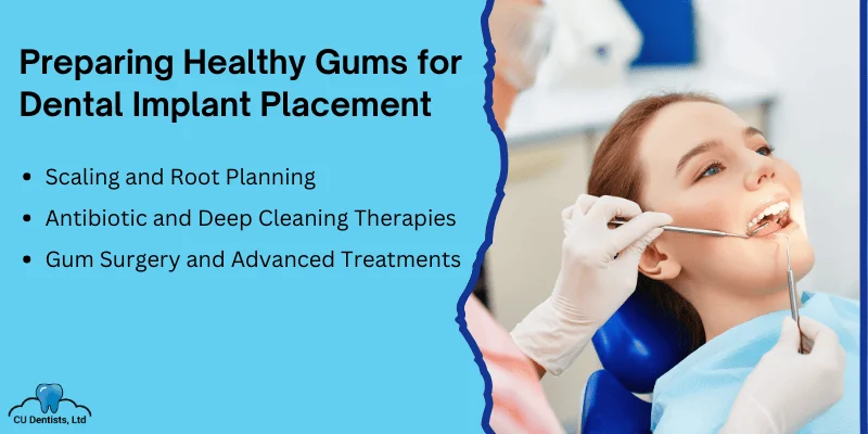 Treating Gum Disease Before Dental Implant Placement