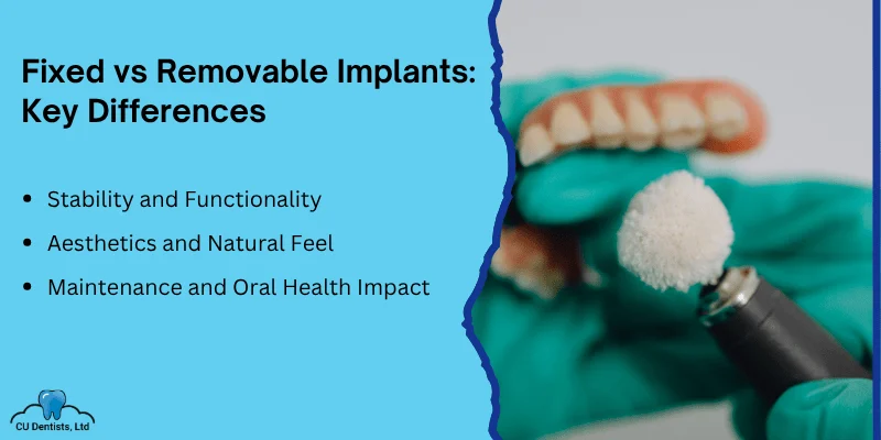 Comparing Fixed vs. Removable Implants