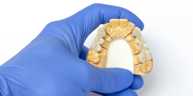Types of Dental Implant Materials