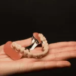 Dental Implant Alternatives
