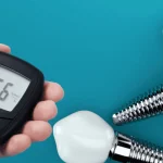 Diabetes and Dental Implants Success