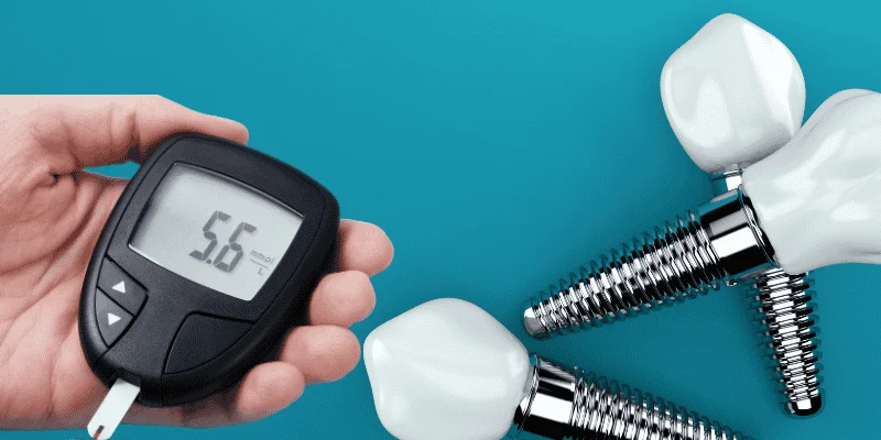 Diabetes and Dental Implants Success