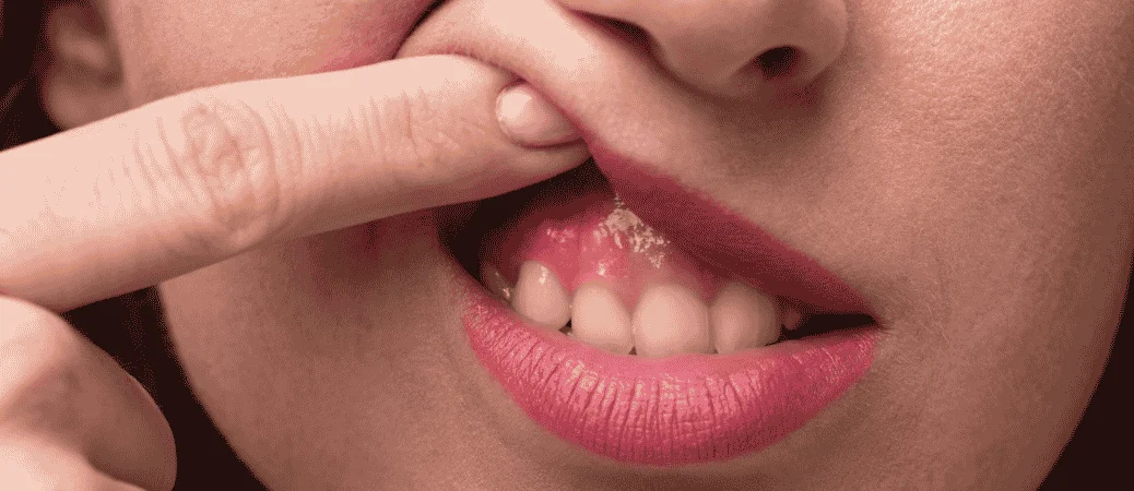 Dental Implant Infection Signs
