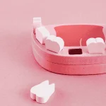 Tooth Loss Statistics US vs Champaign IL