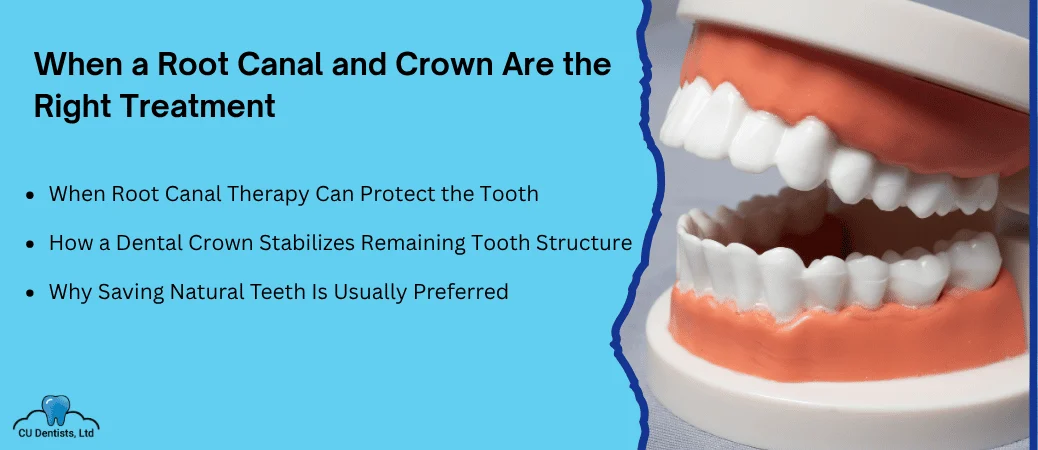 When Root Canal Treatment and a Crown Make Sense